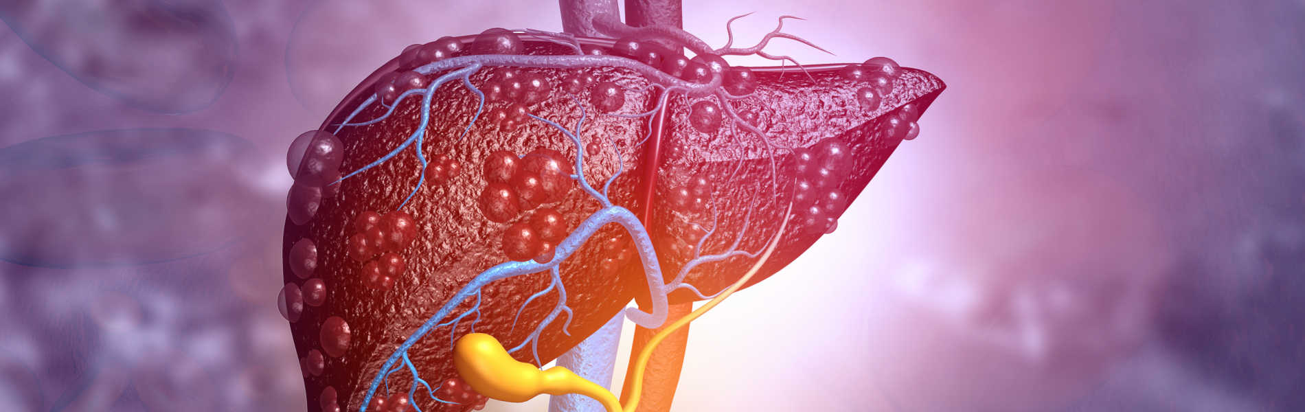 slide epatite pediatrica ISS